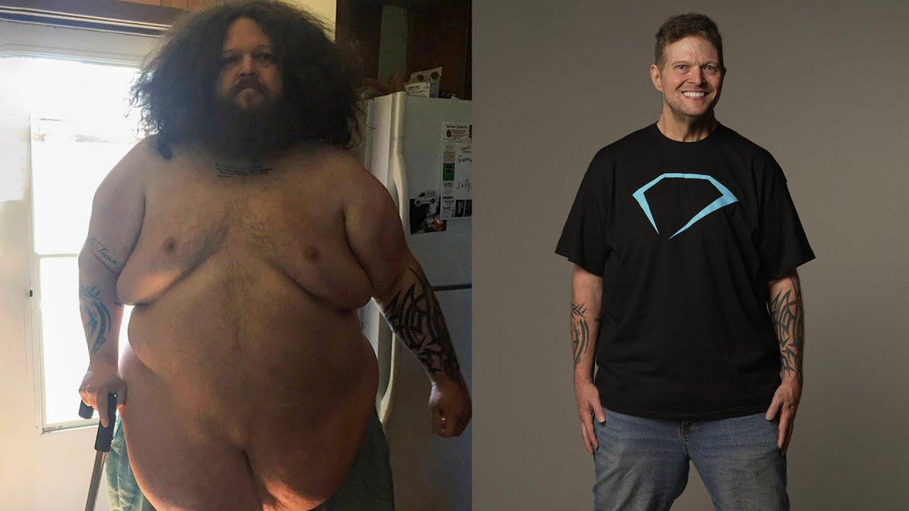 Ken is Unrecognizable After Losing 305 lbs and a Smile Makeover!